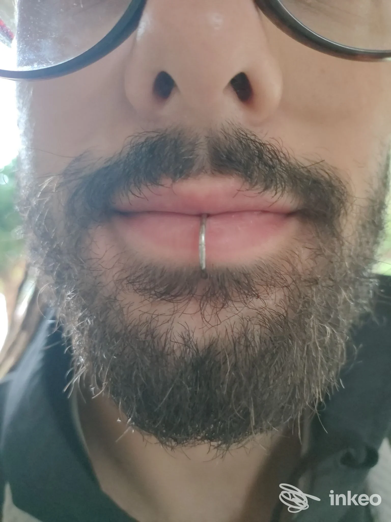Morso vicino mostra un piercing labiale verticale posizionato al centro della labbra inferiori di una persona con baffo e barba, occhiali, in primo piano.