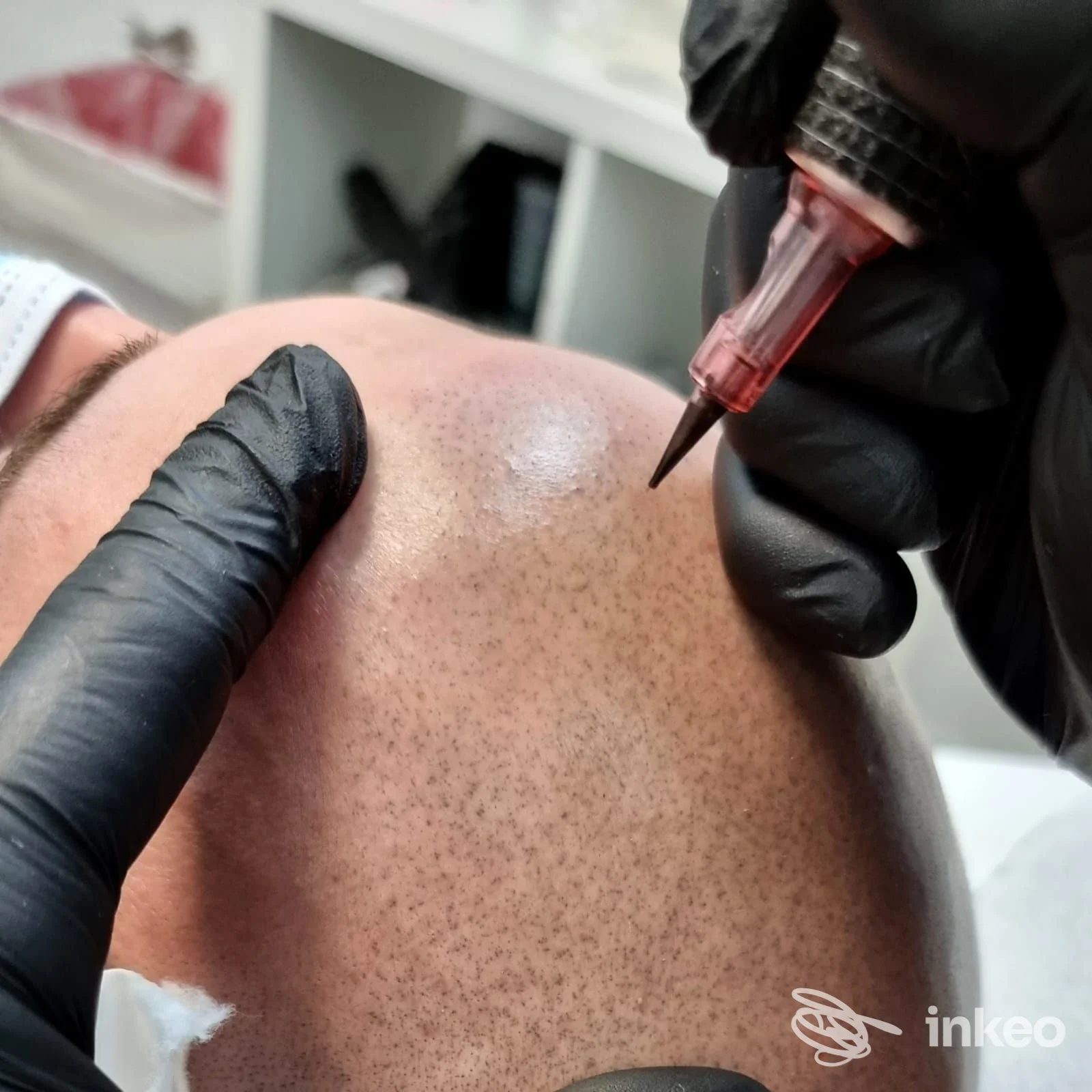 Procedura di trucco permanente o micropigmentazione su guancia di una persona, con operatore che usa una penna tatuatrice.