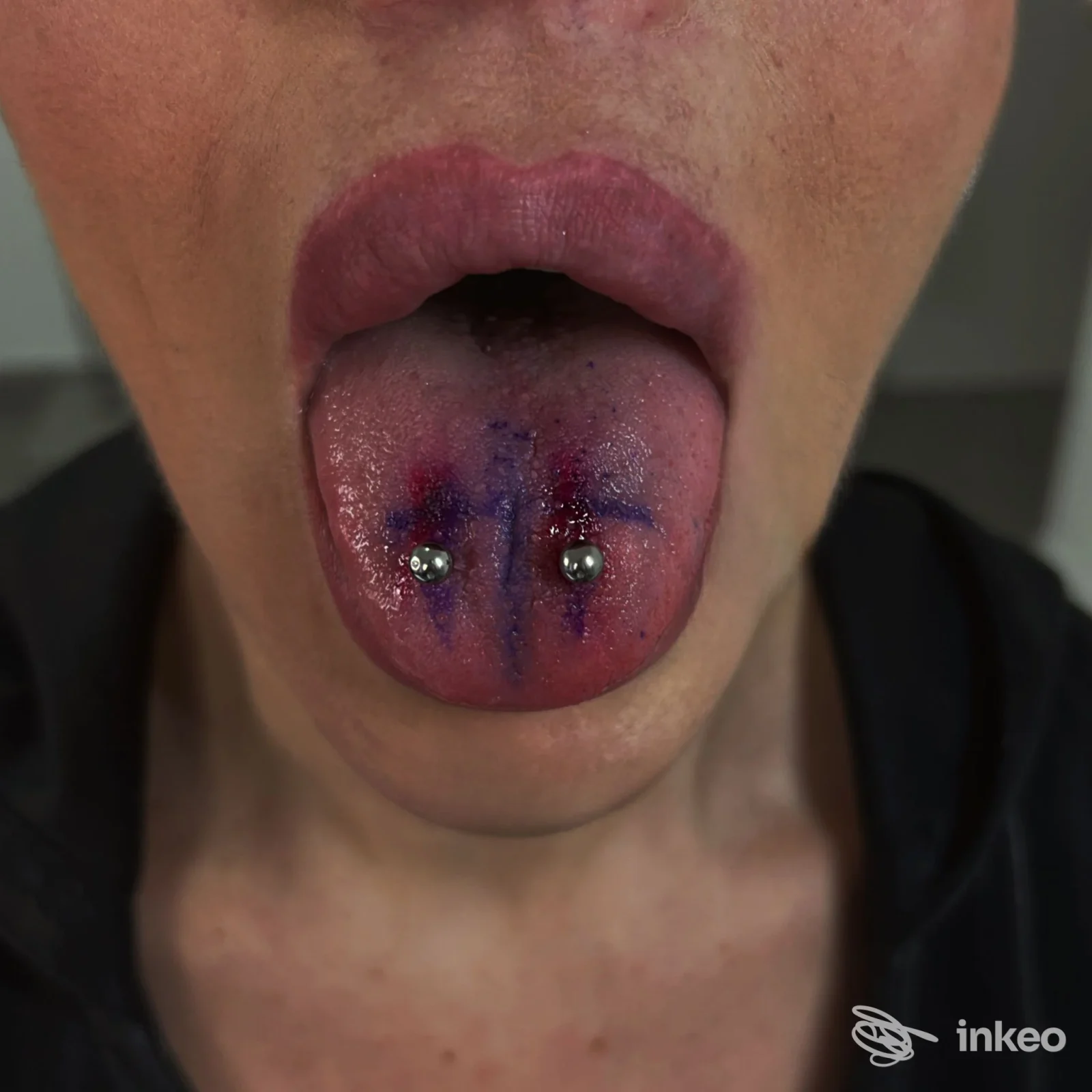 Lingua penzolante con due piercing labiali sul davanti della lingua, con piccole palline metalliche e macchie di colore blu visibili sul tessuto linguale.