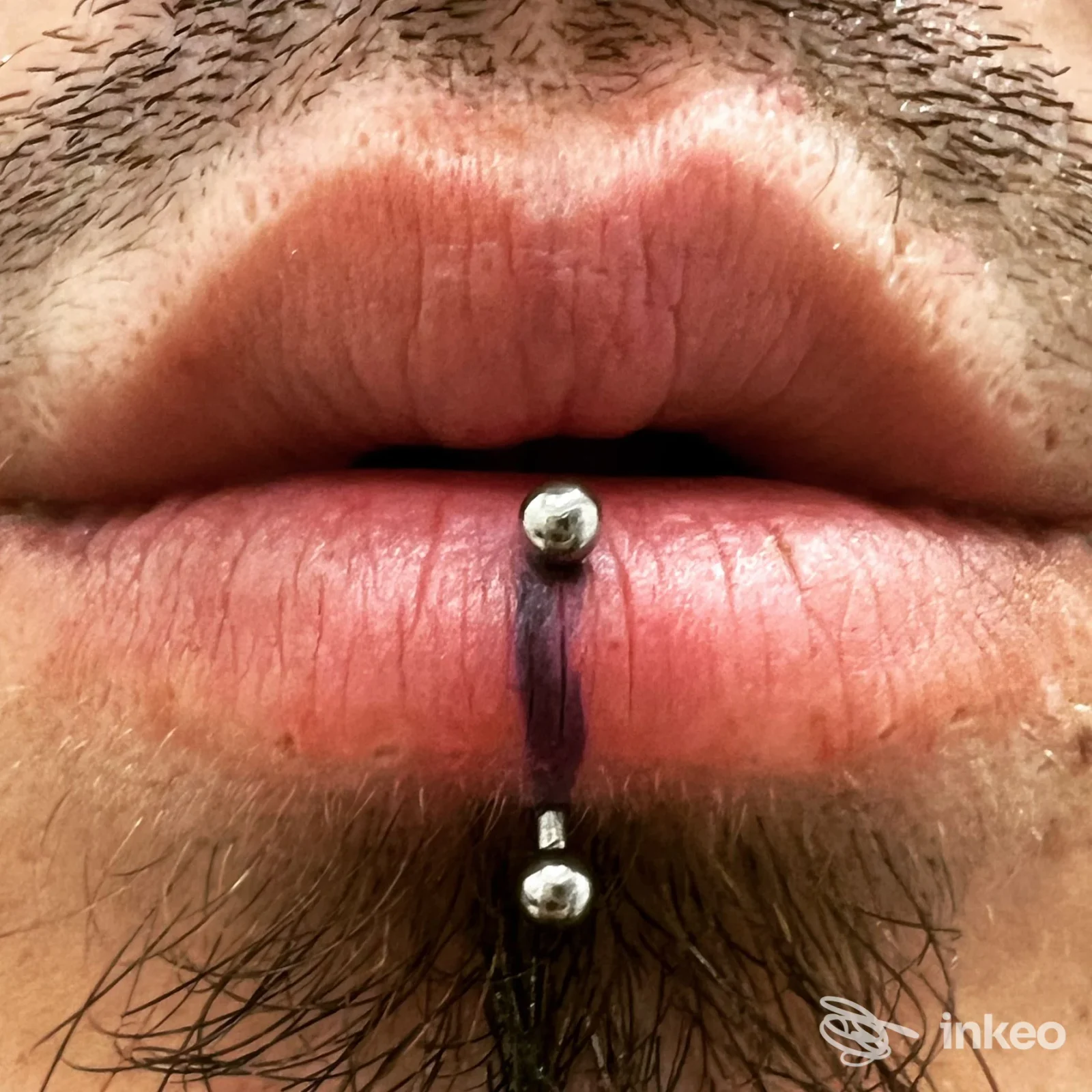Labbro inferiore con piercing verticale, due palline metalliche in evidenza; foto realistica pubblicata da Danierix Piercing Studio, Napoli.