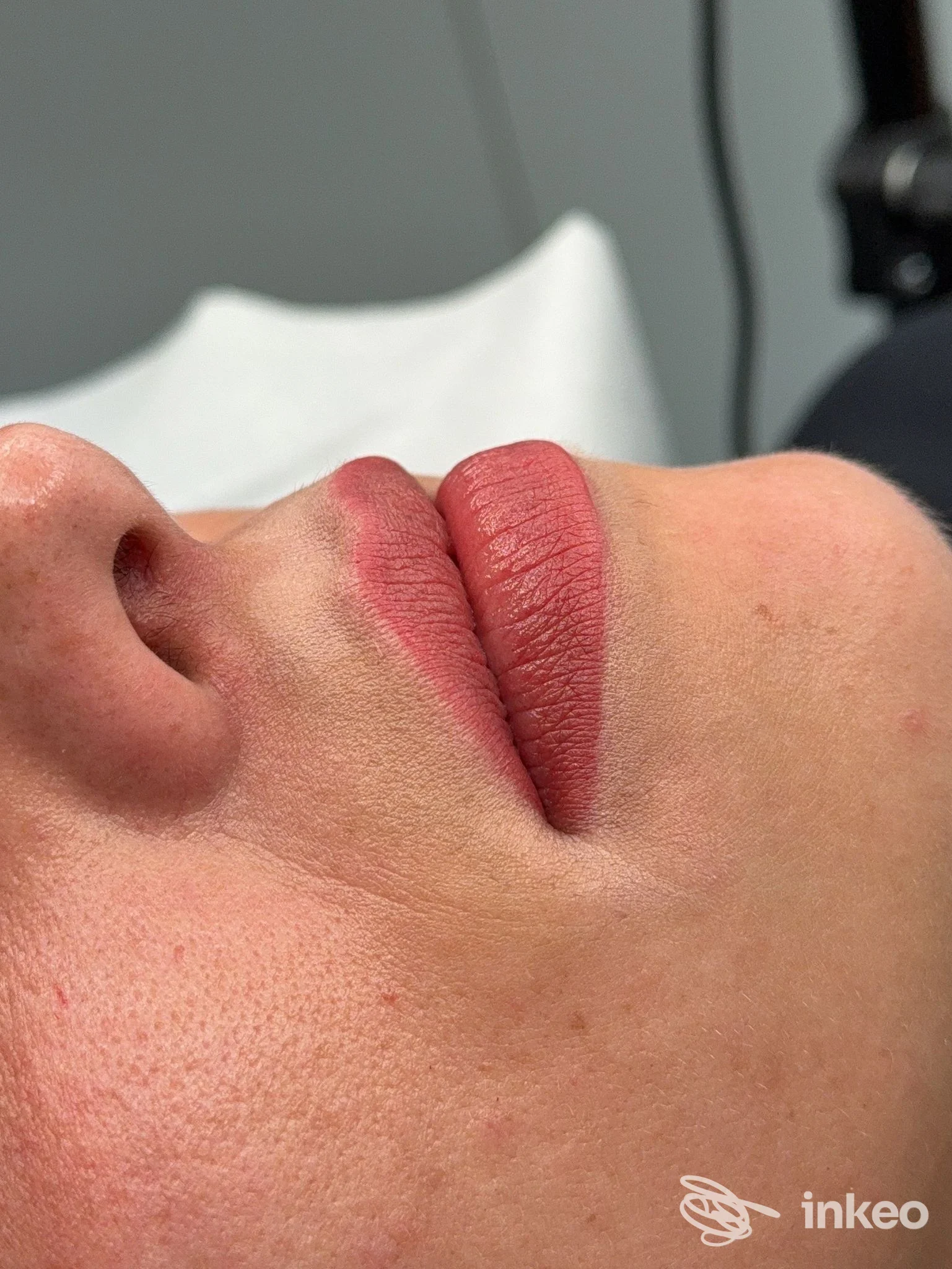 Labbra pigmentate con trucco permanente visibile sul viso di una persona, in primo piano di lato.