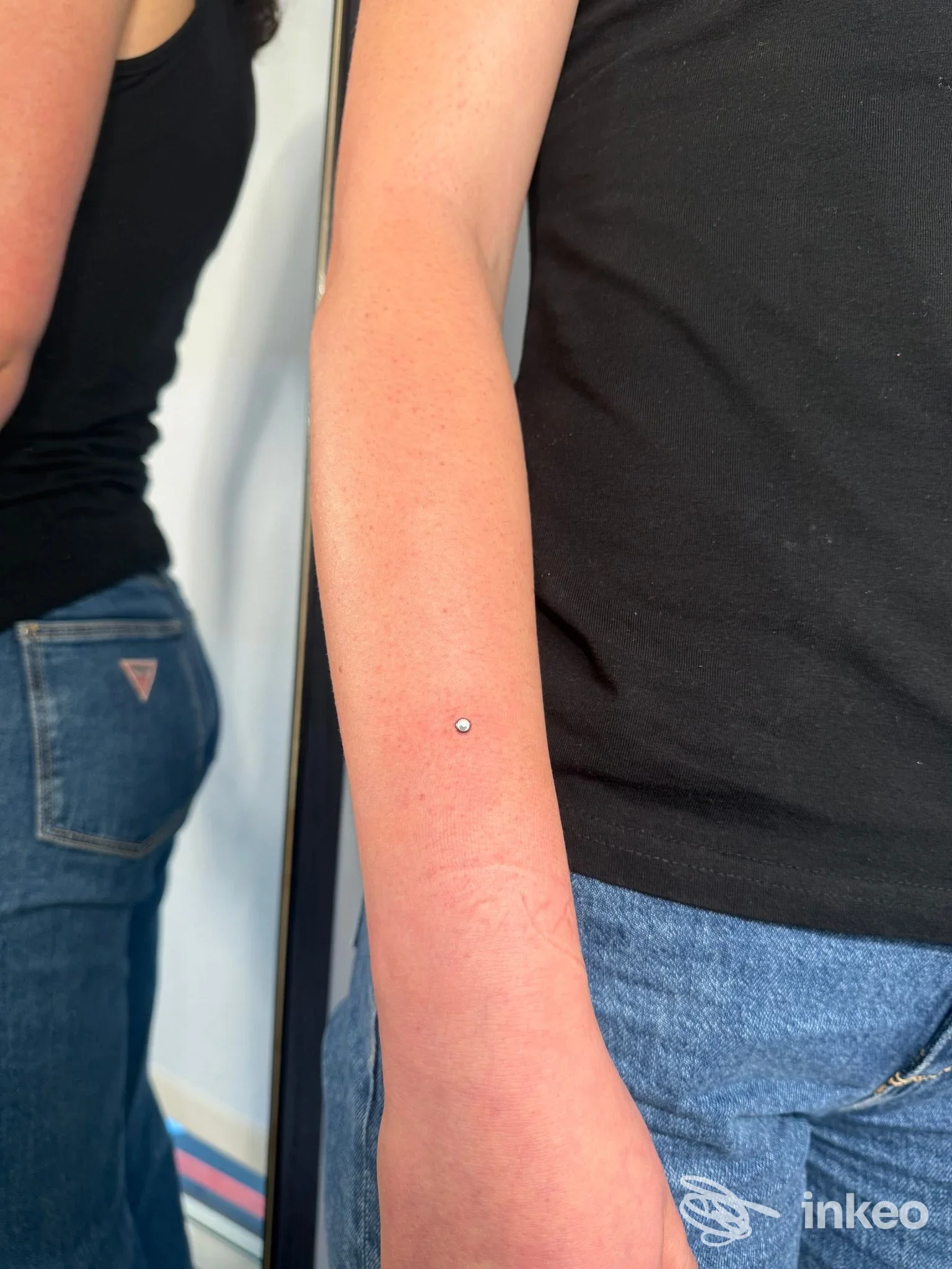 Microdermal sull'avambraccio destro fotografato in studio — Nonsolopiercing Studio, Udine.