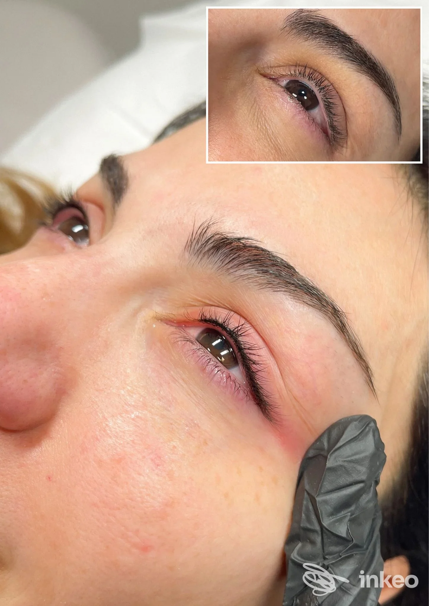 Primo piano di eyeliner permanente appena eseguito sulla palpebra superiore di una cliente, dettaglio del tratto e della pelle. DHERMO, Limena.