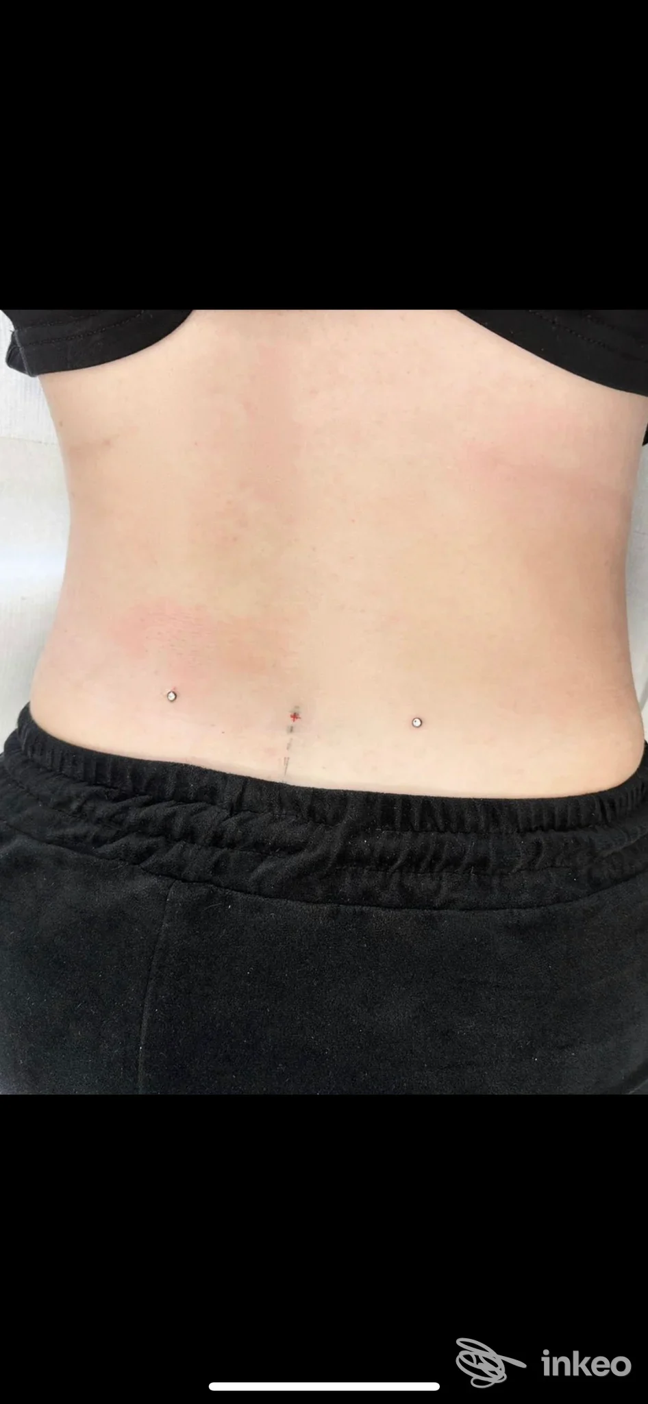Vista della zona lombare con tre microdermal visibili al centro della schiena, lavoro di Alex Tattoo Studio a Novara.