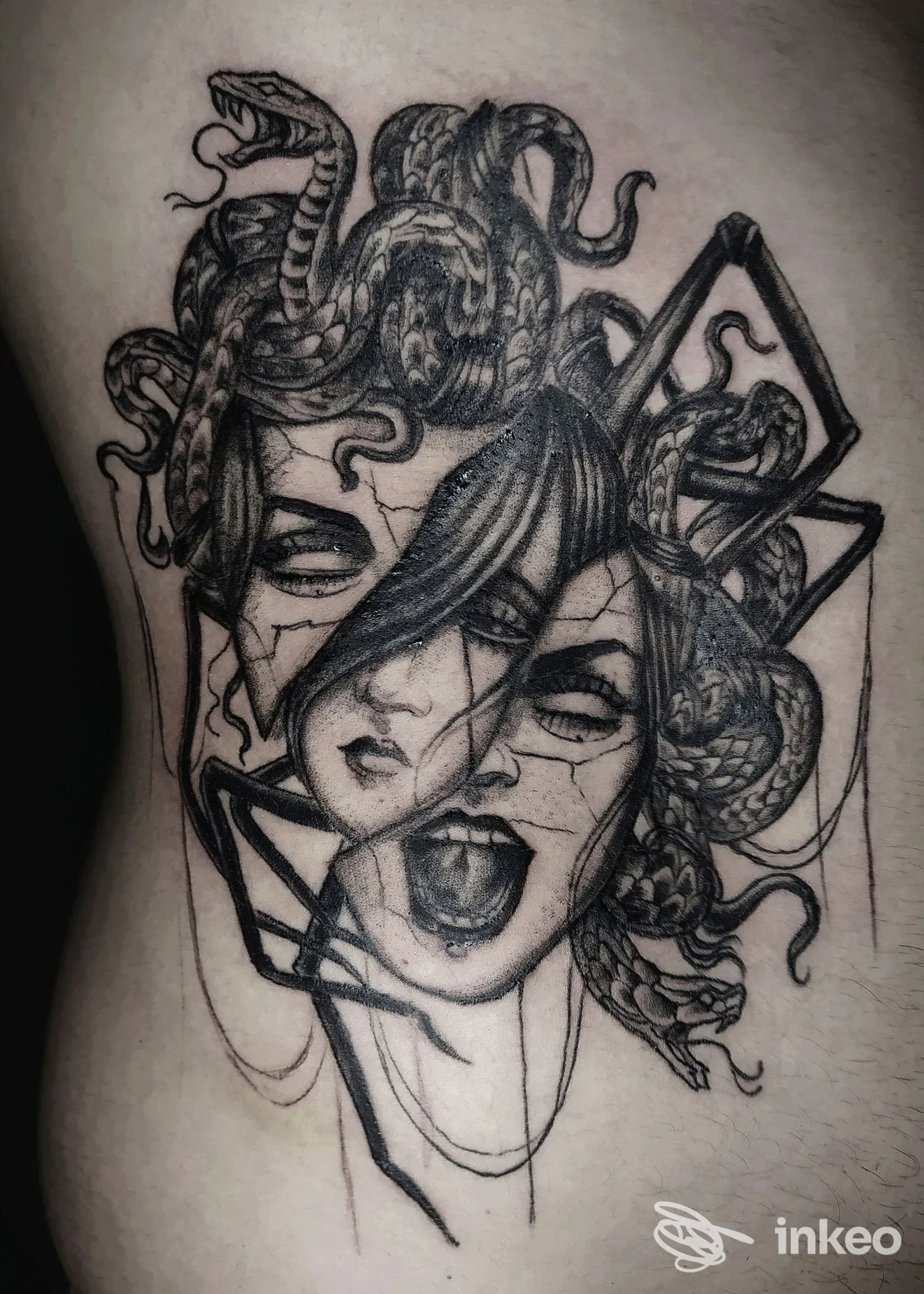 Tatuaggio Medusa in bianco e nero su pelle, foto inviata dallo studio Black Medusa Tattoo di Trani.