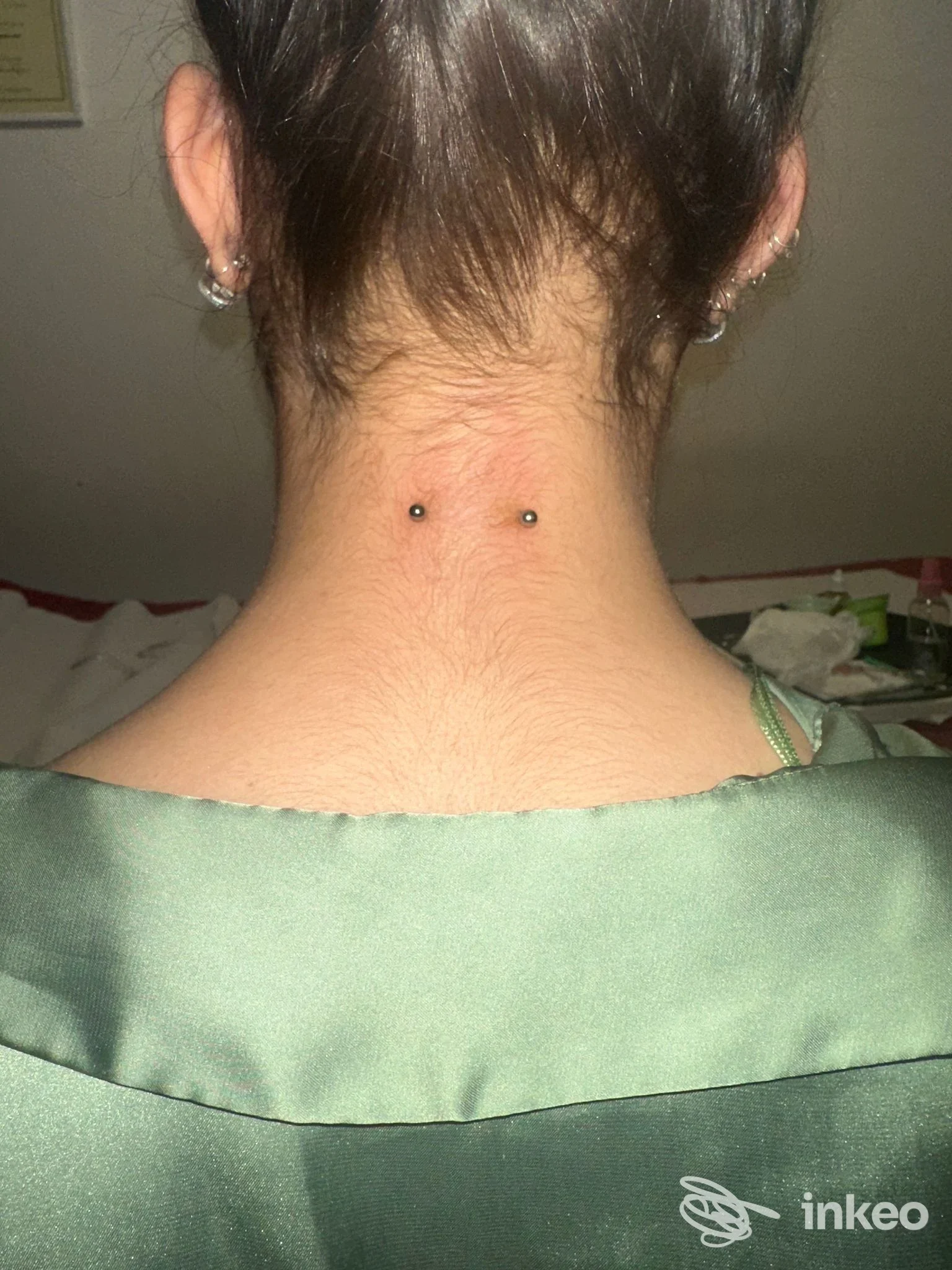 Due microdermal o surface piercing centrati sulla nuca, foto scattata in interno. Elisabeth Body Piercing, Terrasini.