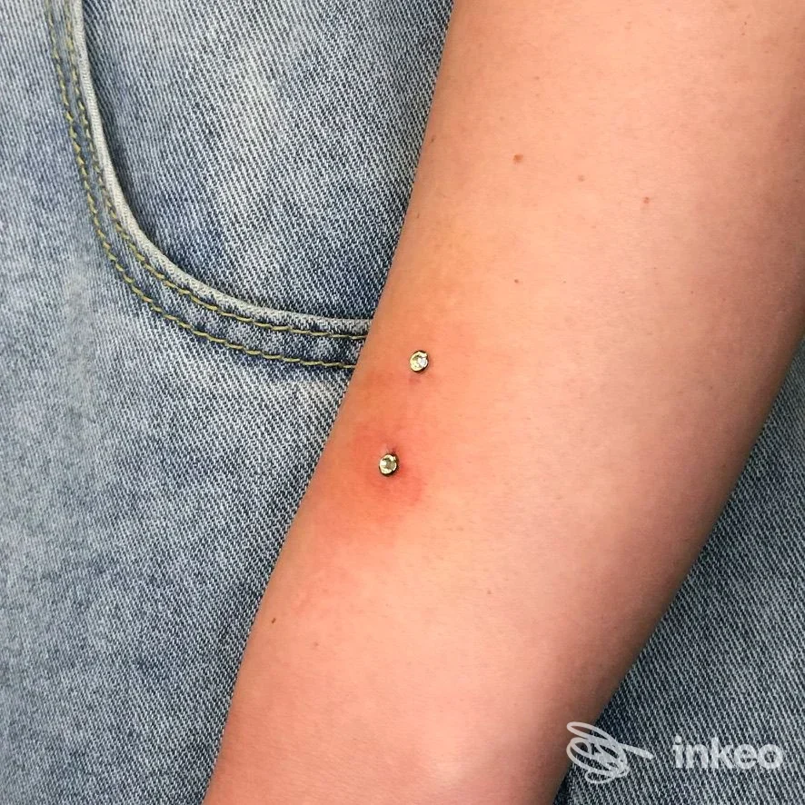 Due microdermal con gemma visibili sull'avambraccio, lavoro eseguito da Anele Piercing, Firenze.