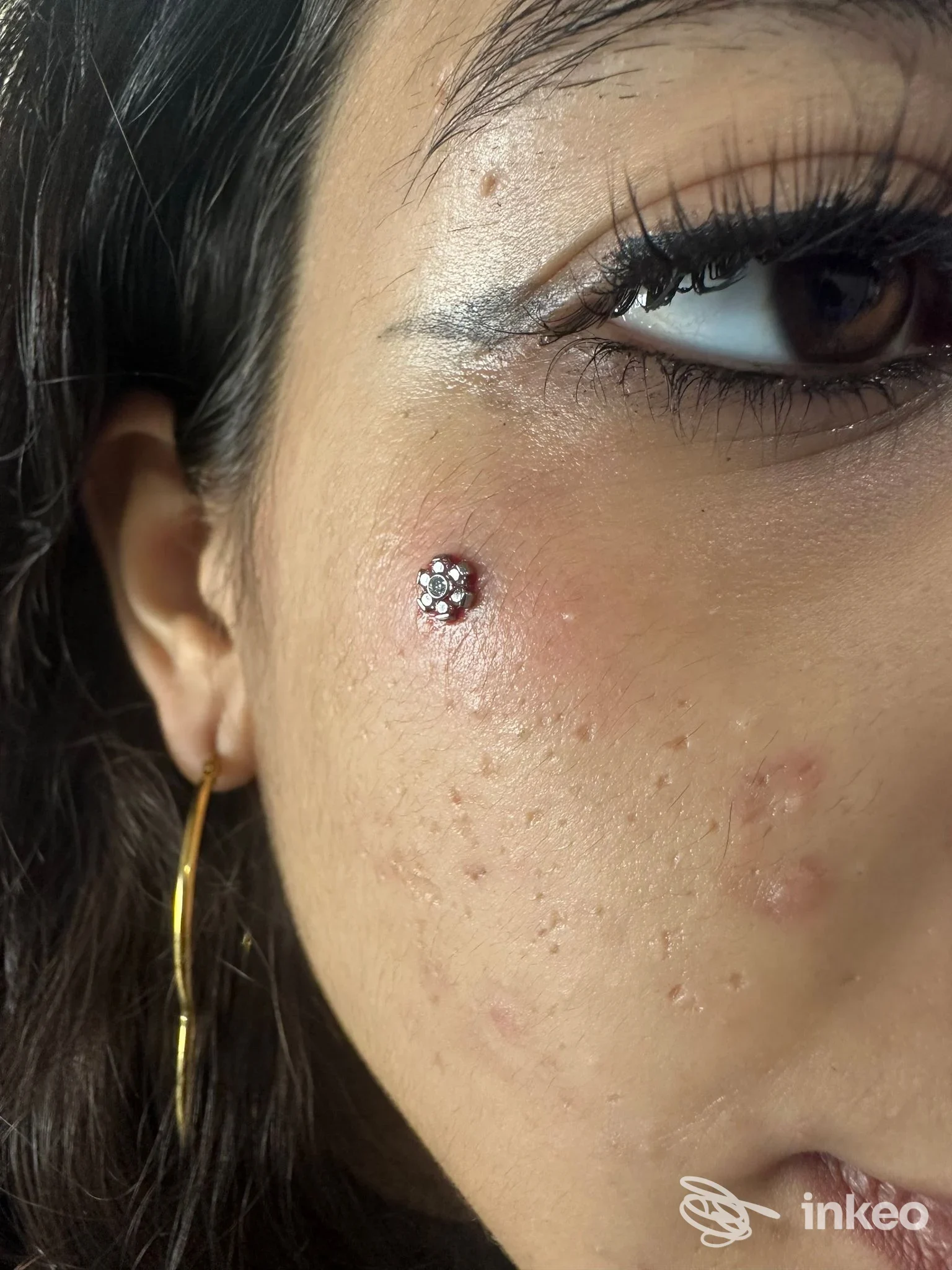 Primo piano su piercing alla guancia con gioiello floreale e lieve arrossamento, volto ritagliato in dettaglio.