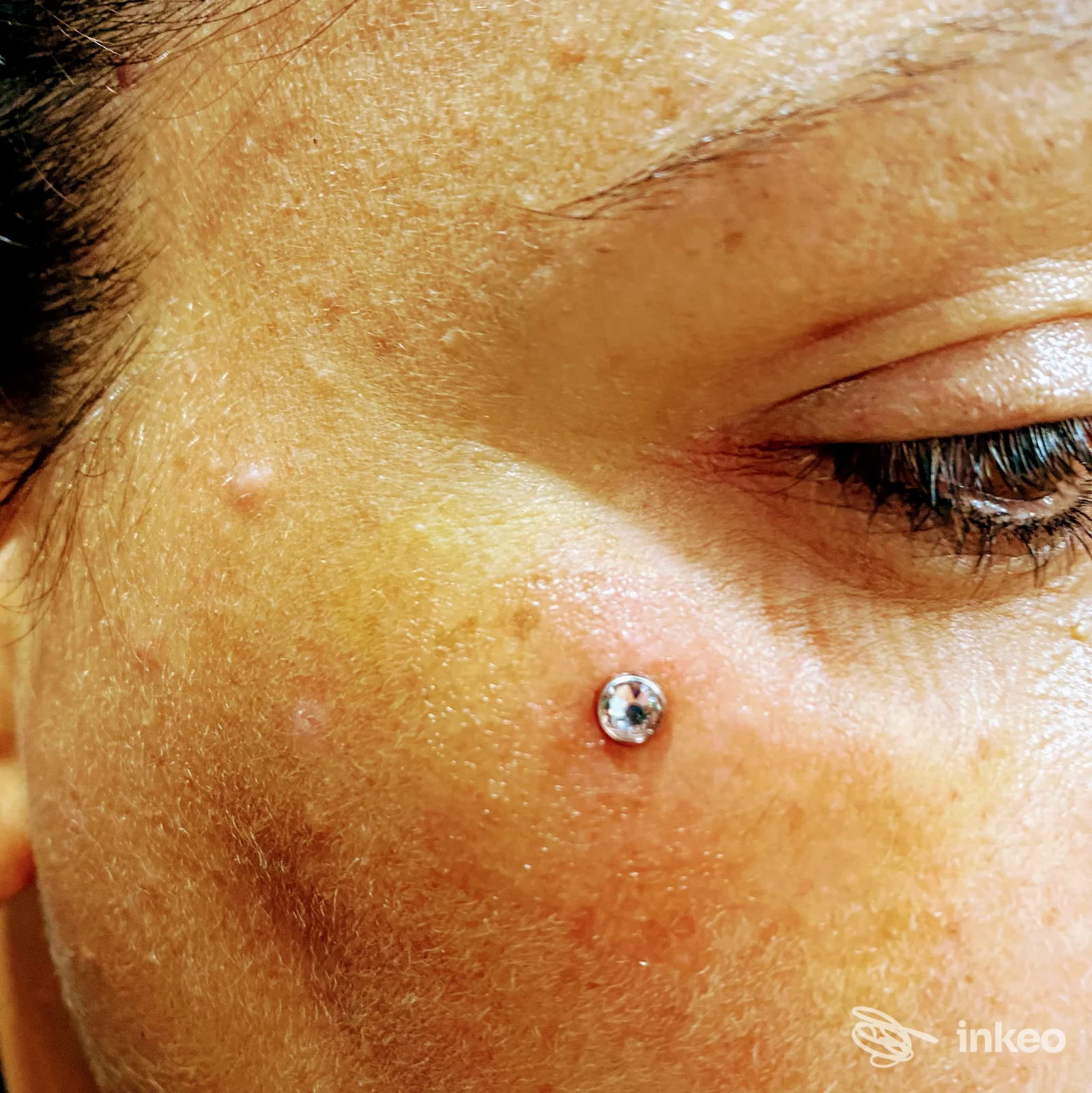 Primo piano di un piercing dermico sullo zigomo, foto fornita da Nina Rock Ink Tattoo & piercing studio, Aprilia.