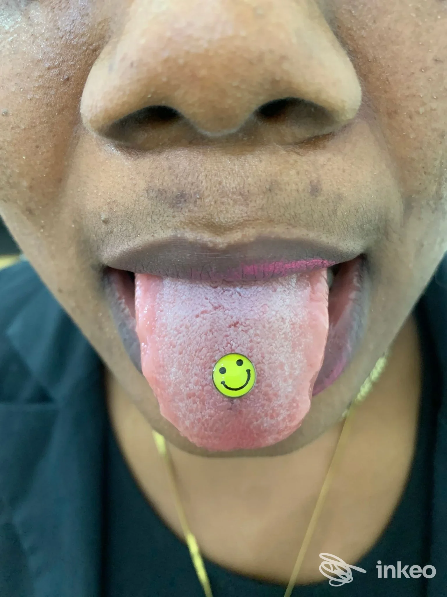 Primo piano piercing alla lingua con gioiello smiley, foto fornita da MOSÉ BEAUTY SHOP, Napoli.