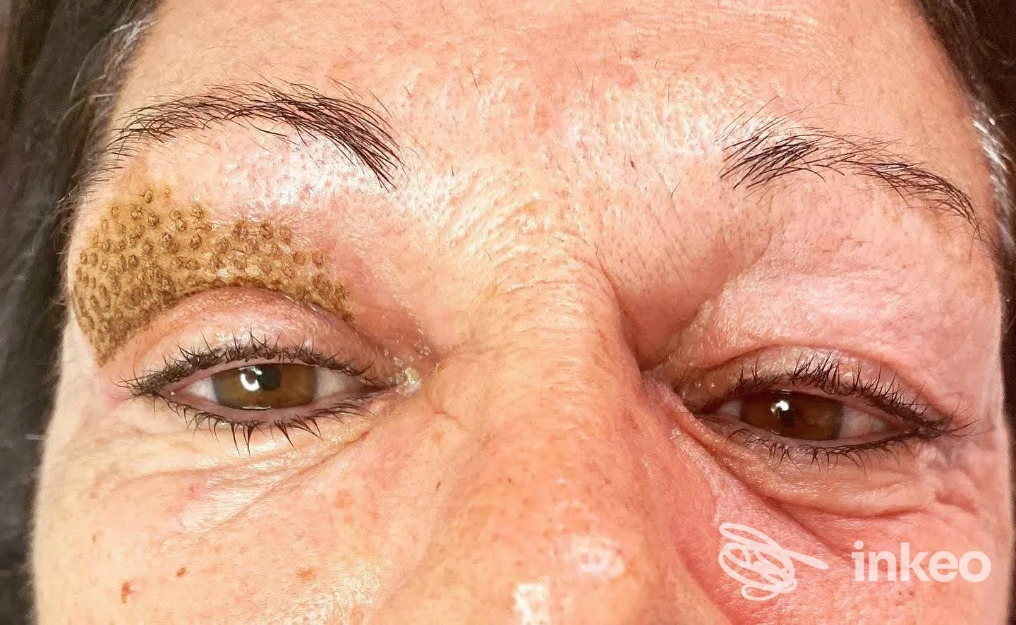 Dettaglio di dermopigmentazione sopracciglio/palpebra in fase di guarigione, immagine fornita da Sopracciglia d'autore Laura Fio, Bari.