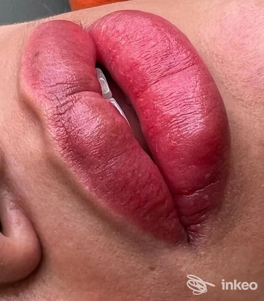 Primo piano di labbra pigmentate con trucco permanente, immagine fornita da MAGDA BEAUTY STUDIO, Seriate.