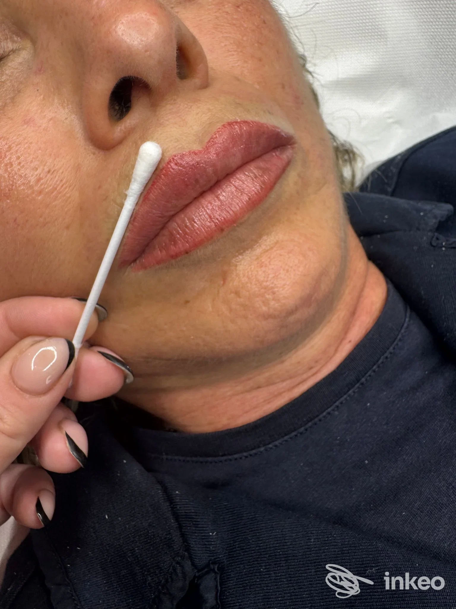 Labbra con trucco semipermanente trattato presso DM Derma Beauty Piercing, Porto Torres, vista ravvicinata durante il procedimento.