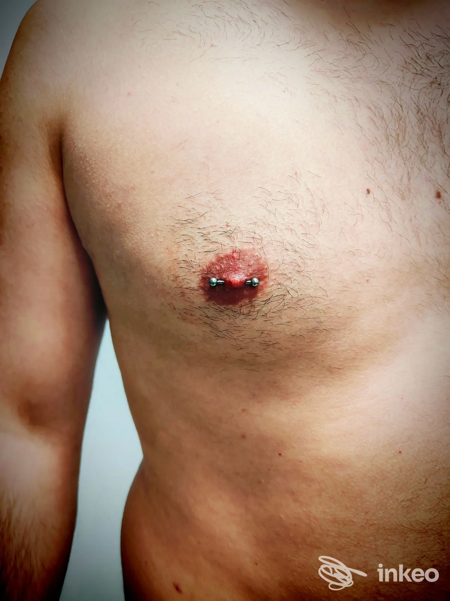 Piercing al capezzolo sinistro di una persona, visibile nastro metallico con sfere alle estremità, in primo piano sul torace.